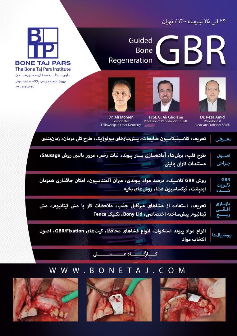 دوره guided bone regeneration  - تاریخ برگزاری ۲۴ الی ۲۵ تیر ۱۴۰۰